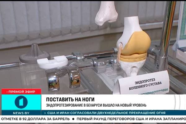 За 2025 год в Беларуси выполнили около 19,5 тыс. операций по замене суставов