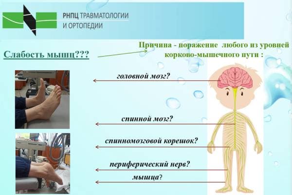 Дифференциальная диагностика уровня поражения нервных структур с помощью нейрофизиологических методов.